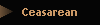 Ceasarean