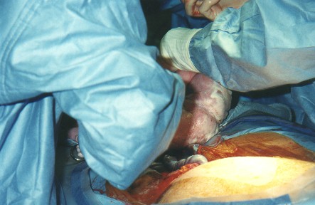 Sp05^021